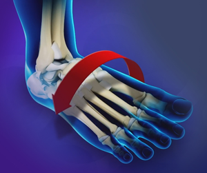 Ankle Instability Surgery