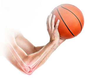 Throwing Injuries of the Elbow