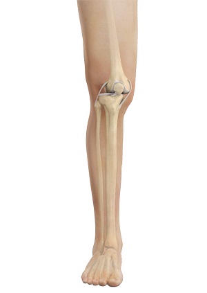 Knee Dislocation