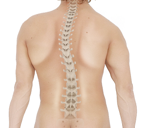 Kyphosis