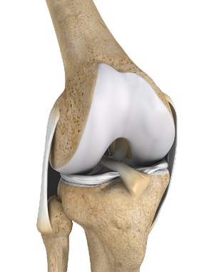 Multiligament Instability