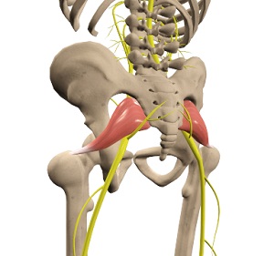 Piriformis Syndrome