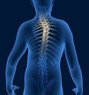 Spine Deformities